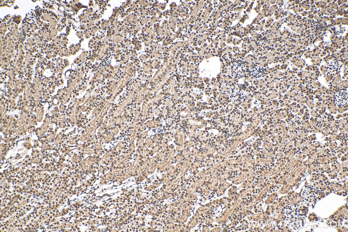 Immunohistochemistry (IHC) staining of mouse kidney tissue using PXR Monoclonal antibody (67912-1-Ig)