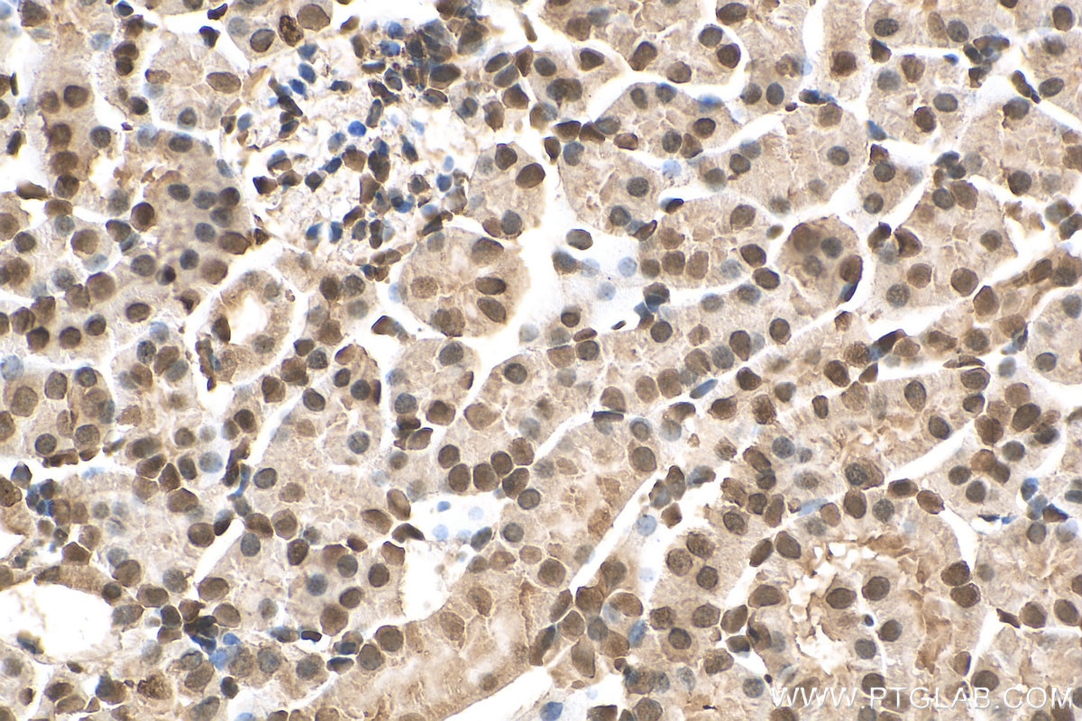 Immunohistochemistry (IHC) staining of mouse kidney tissue using PXR Monoclonal antibody (67912-1-Ig)