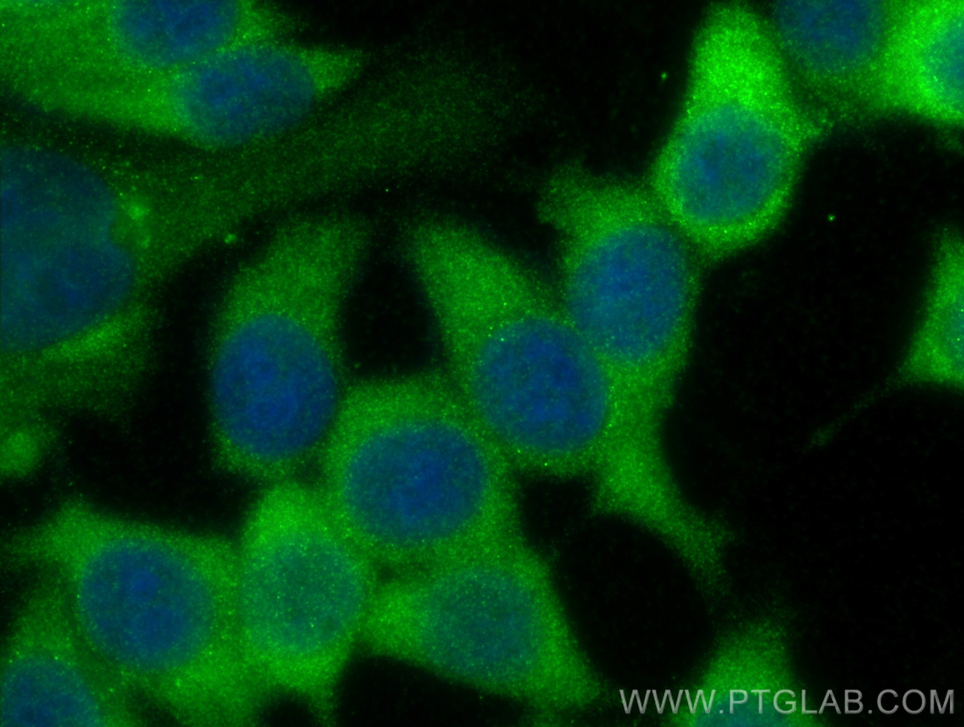 Immunofluorescence (IF) / fluorescent staining of MCF-7 cells using PYCARD Polyclonal antibody (30641-1-AP)