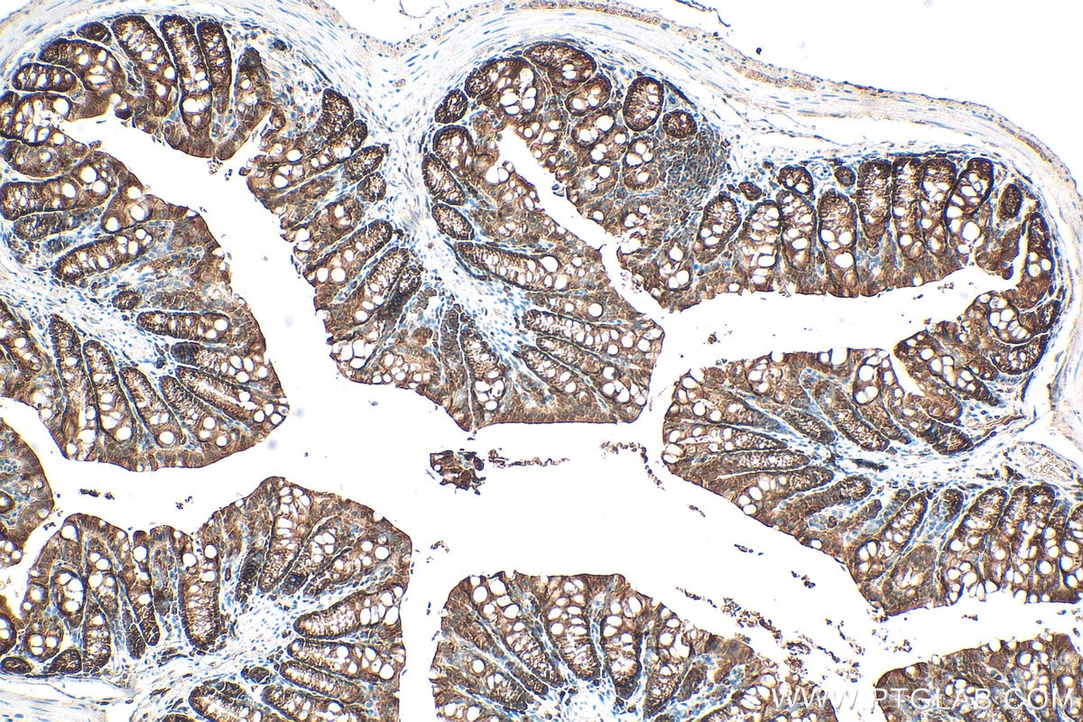 Immunohistochemical analysis of paraffin-embedded mouse colon tissue slide using 30641-1-AP (ASC/TMS1 antibody) at dilution of 1:400 (under 10x lens). Heat mediated antigen retrieval with Tris-EDTA buffer (pH 9.0). Immunohistochemistry (IHC) staining of mouse colon tissue using ASC/TMS1 Polyclonal antibody (30641-1-AP)