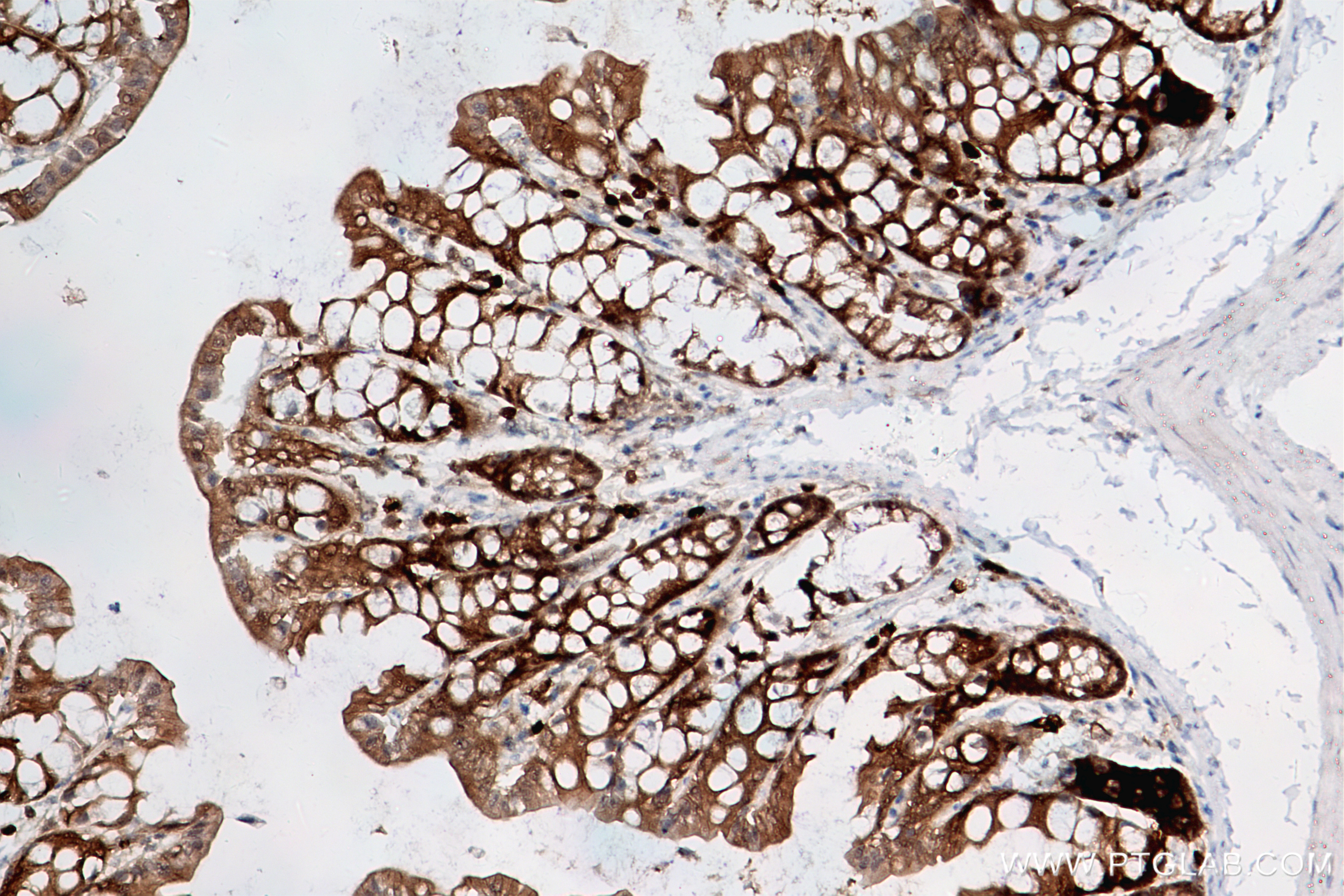 Immunohistochemistry (IHC) staining of mouse colon tissue using ASC/TMS1 Recombinant antibody (83858-3-RR)