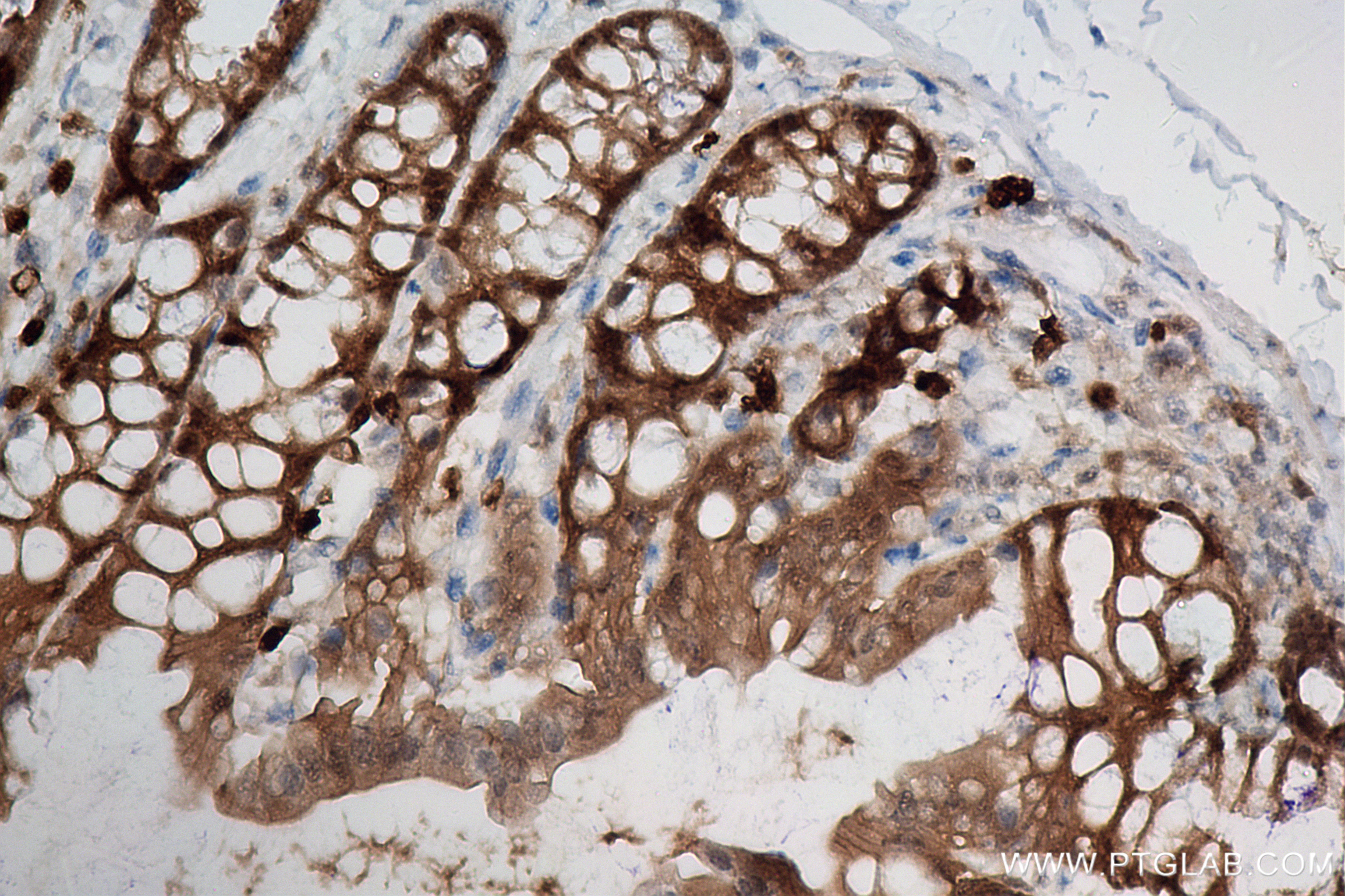 Immunohistochemistry (IHC) staining of mouse colon tissue using ASC/TMS1 Recombinant antibody (83858-3-RR)