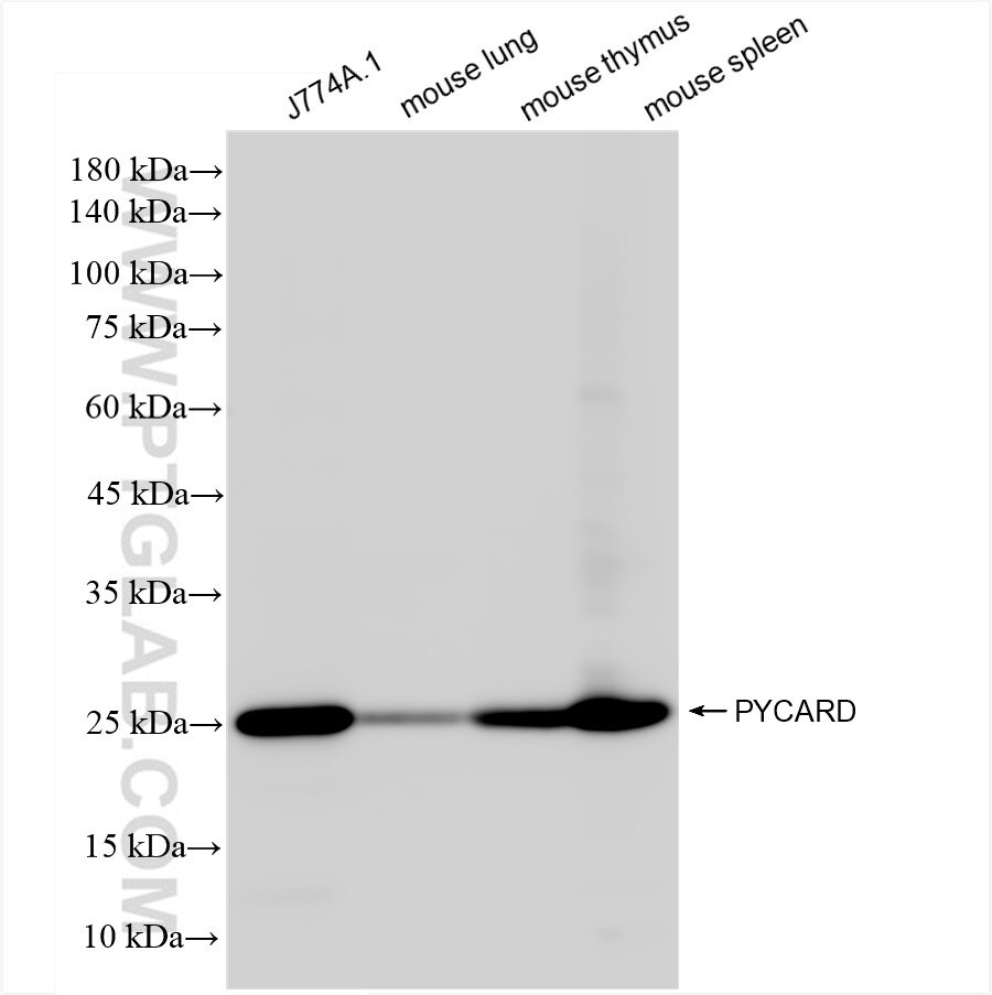 Western Blot (WB) analysis of various lysates using PYCARD Recombinant antibody (83858-3-RR)
