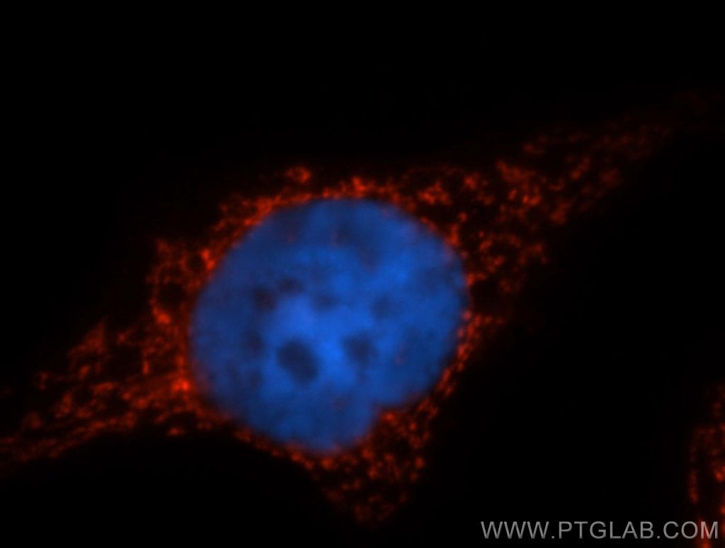 Immunofluorescence (IF) / fluorescent staining of MCF-7 cells using PYCR1 Polyclonal antibody (13108-1-AP)