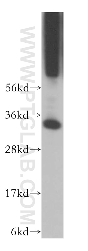 Western Blot (WB) analysis of human brain tissue using PYCR1 Polyclonal antibody (13108-1-AP)