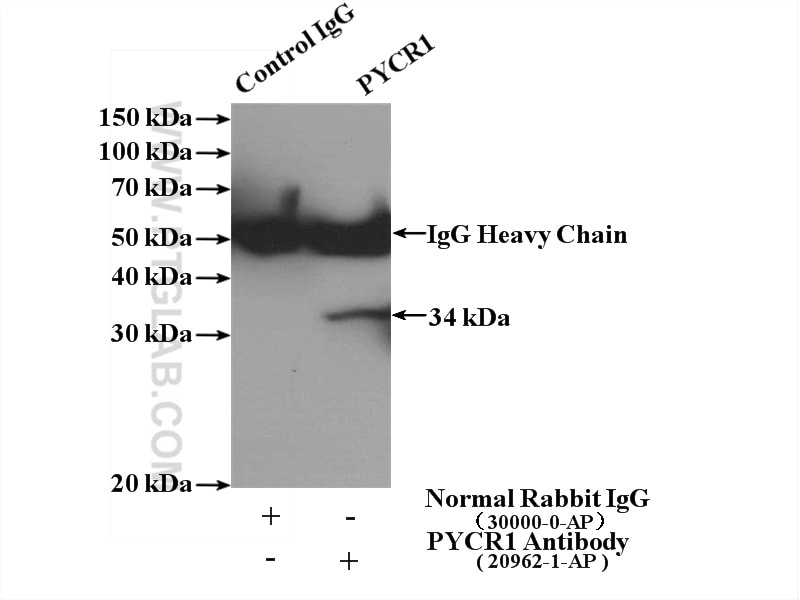 Immunoprecipitation (IP) experiment of Raji cells using PYCR1-specific Polyclonal antibody (20962-1-AP)