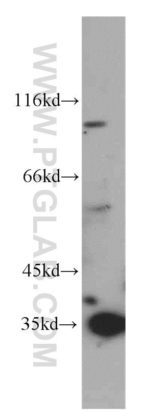 PYCR1-specific