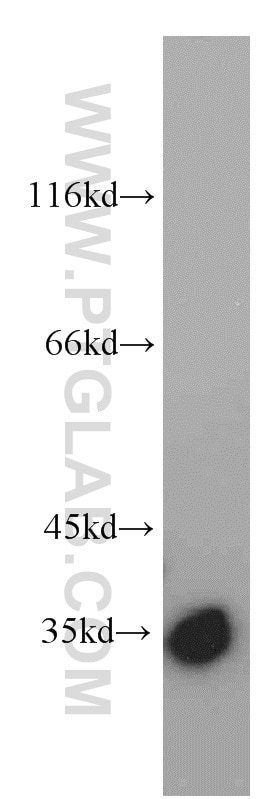 Western Blot (WB) analysis of Raji cells using PYCR1-specific Polyclonal antibody (20962-1-AP)