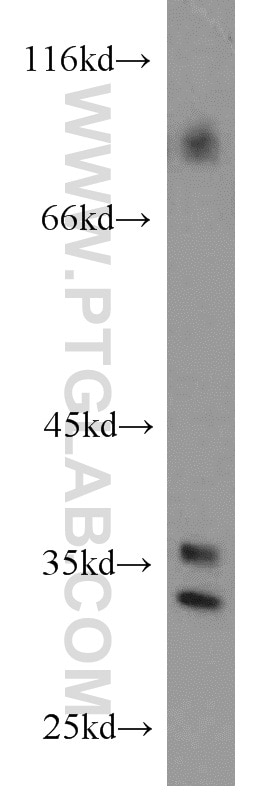 Western Blot (WB) analysis of human brain tissue using PYCR1-specific Polyclonal antibody (20962-1-AP)