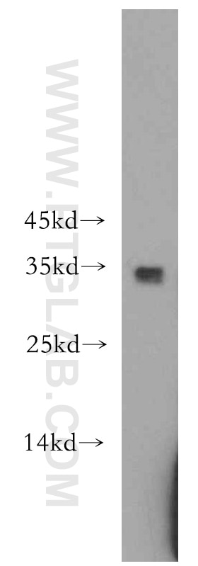 Western Blot (WB) analysis of Raji cells using PYCR1-specific Polyclonal antibody (20962-1-AP)