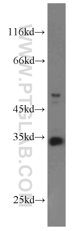 Western Blot (WB) analysis of COLO 320 cells using PYCR1 Polyclonal antibody (22150-1-AP)