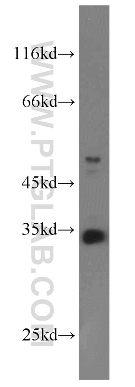 WB analysis of COLO 320 using 22150-1-AP