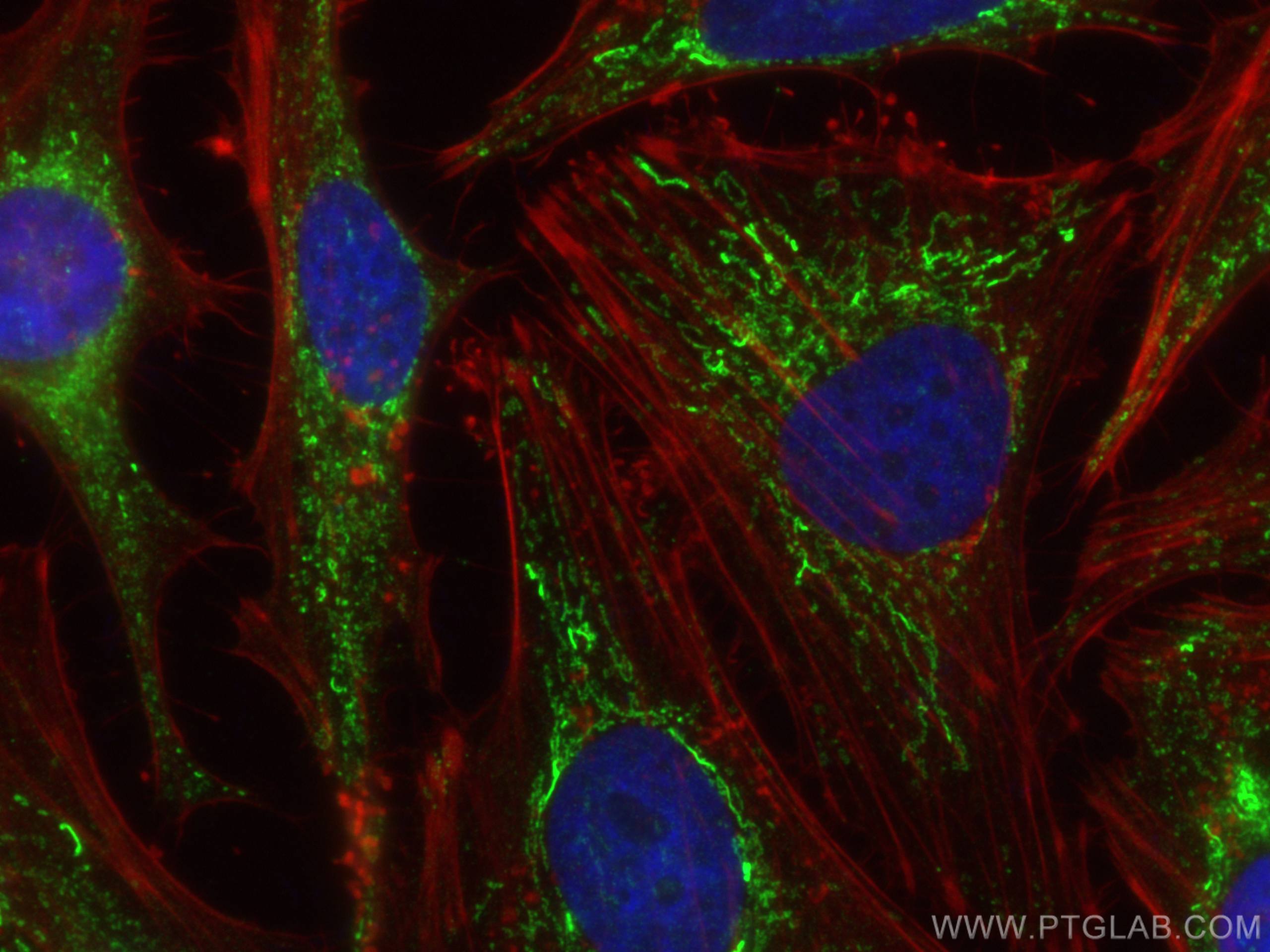 Immunofluorescence (IF) / fluorescent staining of HeLa cells using PYCR1 Monoclonal antibody (66510-1-Ig)