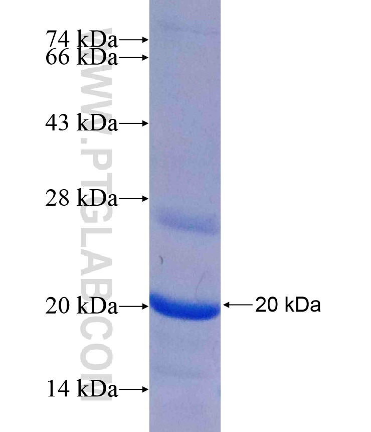 PYCR1 fusion protein Ag17919 SDS-PAGE