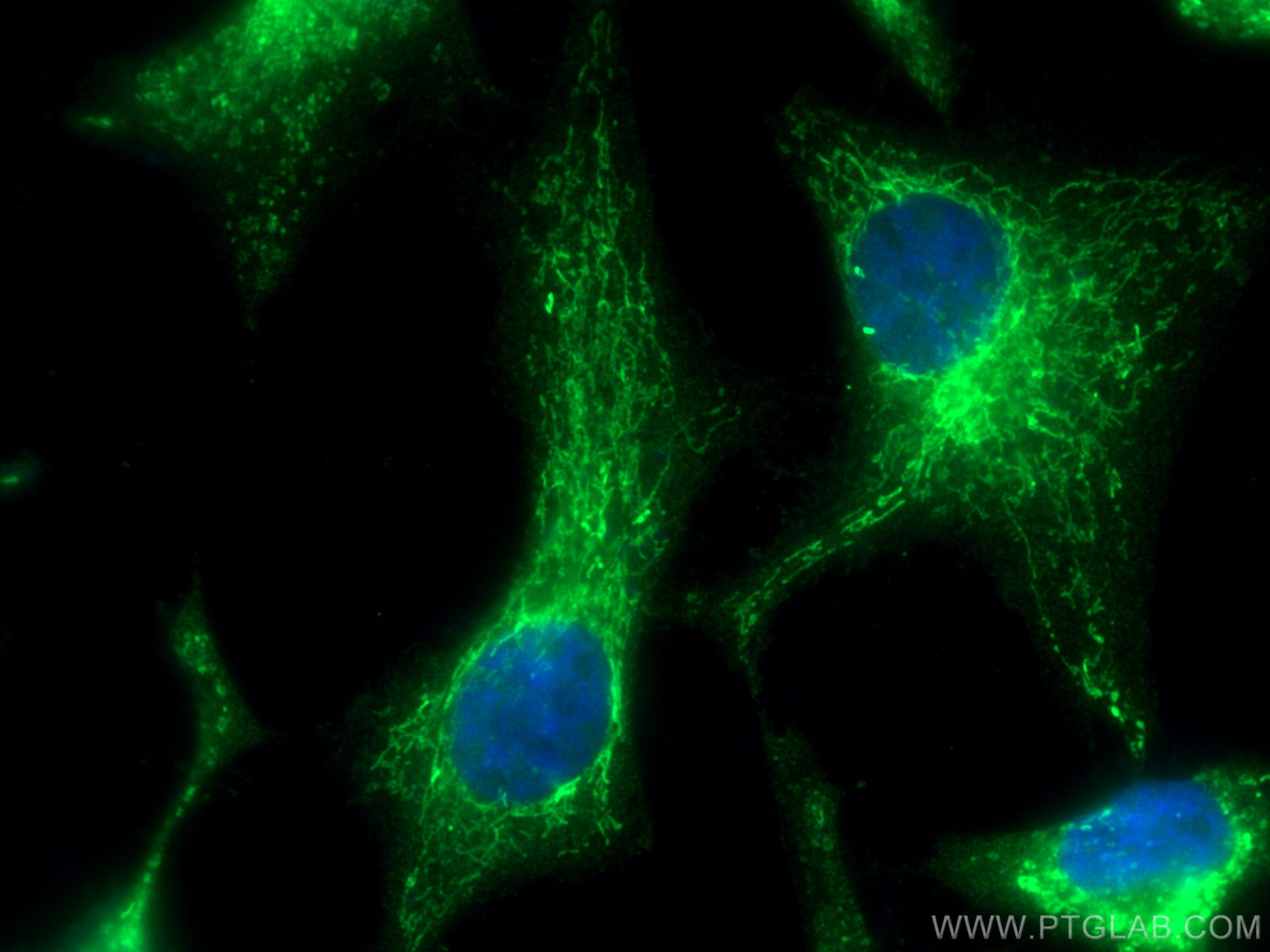 Immunofluorescence (IF) / fluorescent staining of HeLa cells using PYCR2 Polyclonal antibody (17146-1-AP)