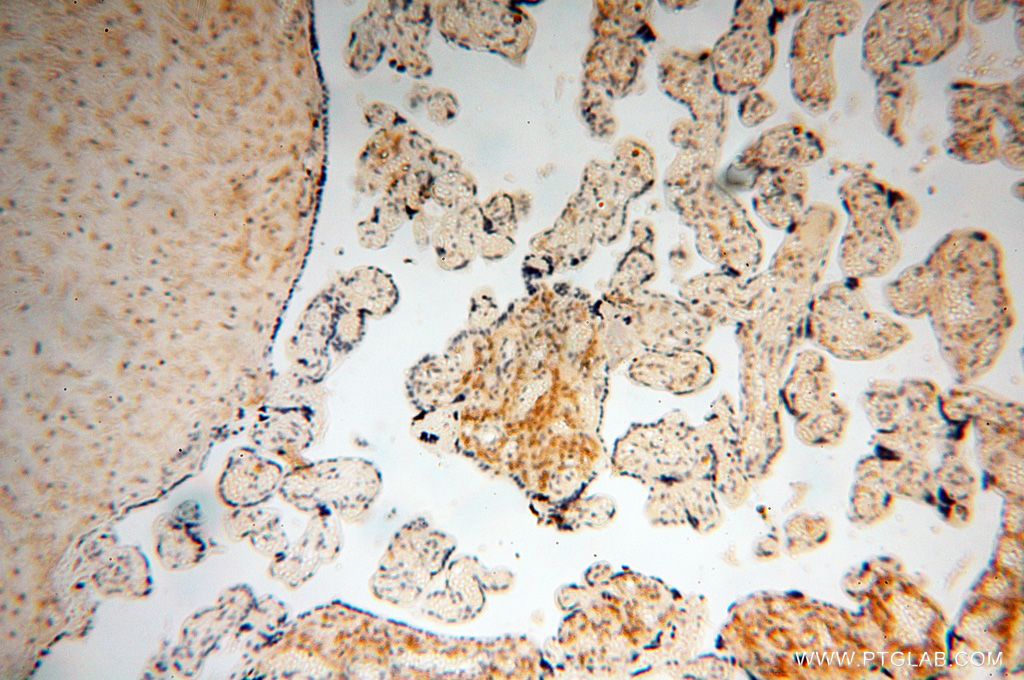 Immunohistochemistry (IHC) staining of human placenta tissue using PYCR2 Polyclonal antibody (17146-1-AP)