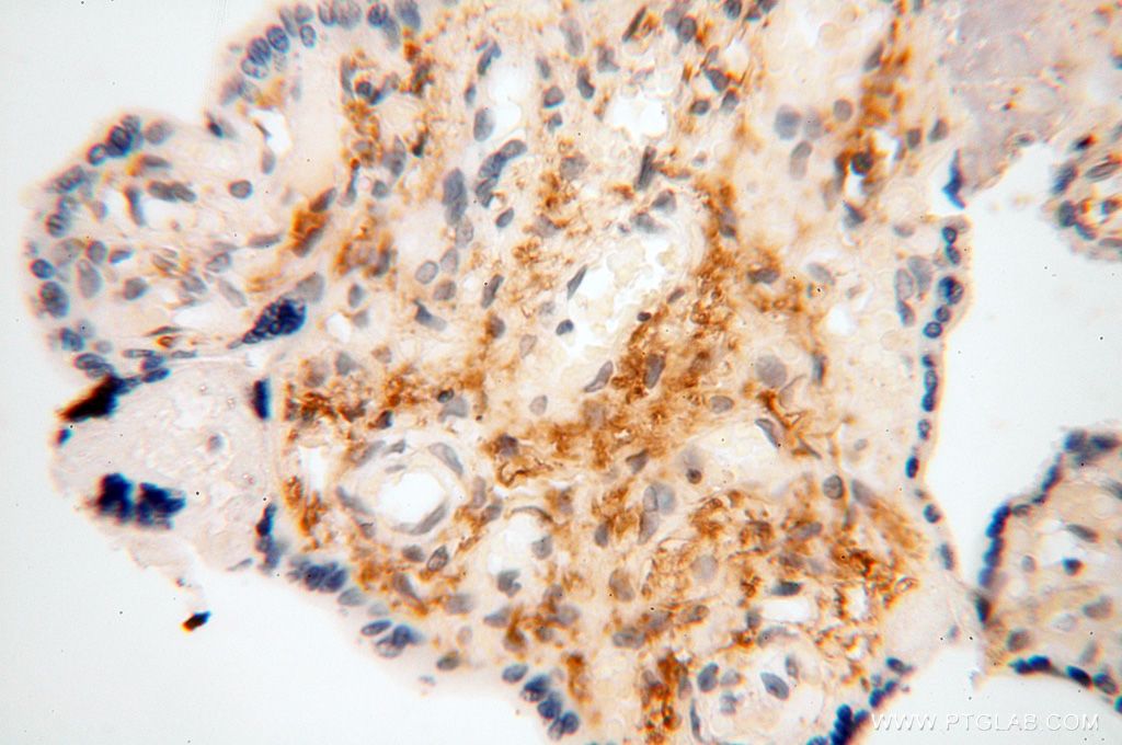 Immunohistochemistry (IHC) staining of human placenta tissue using PYCR2 Polyclonal antibody (17146-1-AP)
