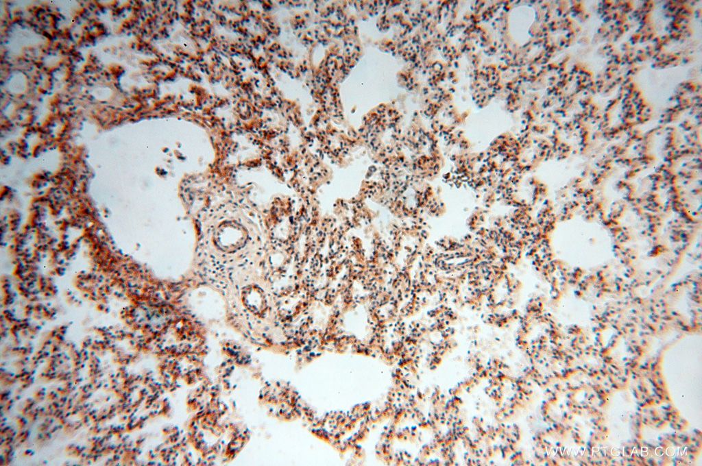 IHC staining of human lung using 17146-1-AP