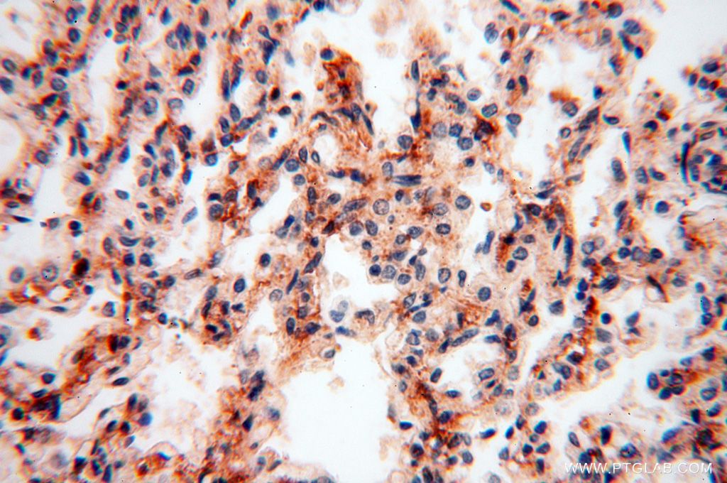 Immunohistochemistry (IHC) staining of human lung tissue using PYCR2 Polyclonal antibody (17146-1-AP)