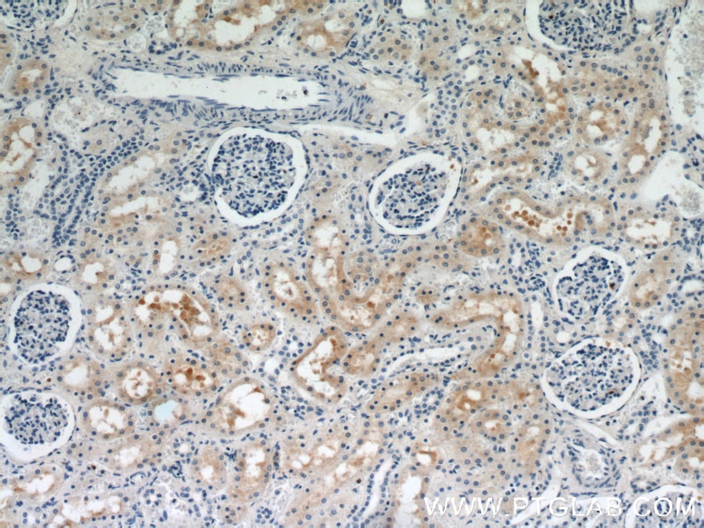 Immunohistochemistry (IHC) staining of human kidney tissue using PYCR2 Polyclonal antibody (17146-1-AP)