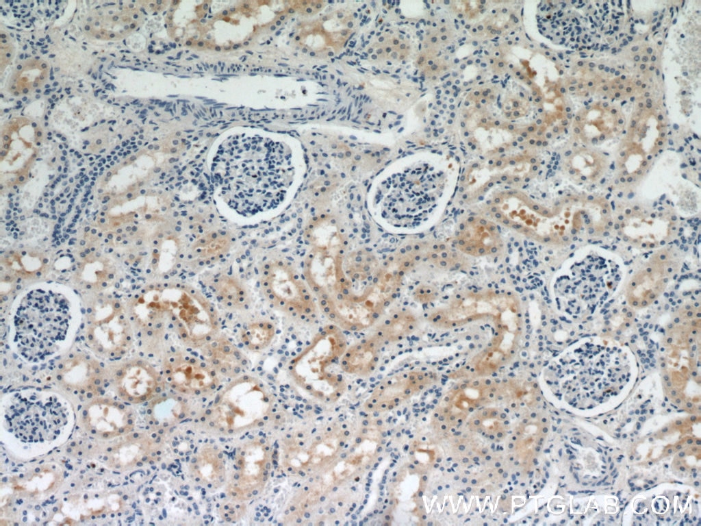 IHC staining of human kidney using 17146-1-AP