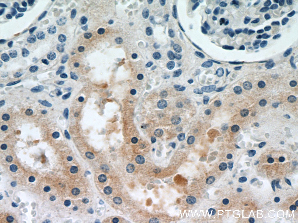 Immunohistochemistry (IHC) staining of human kidney tissue using PYCR2 Polyclonal antibody (17146-1-AP)