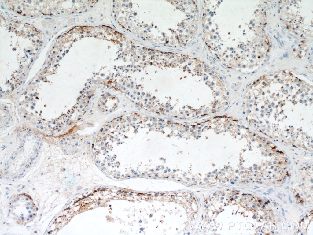 Immunohistochemistry (IHC) staining of human testis tissue using PYCR2 Polyclonal antibody (17146-1-AP)