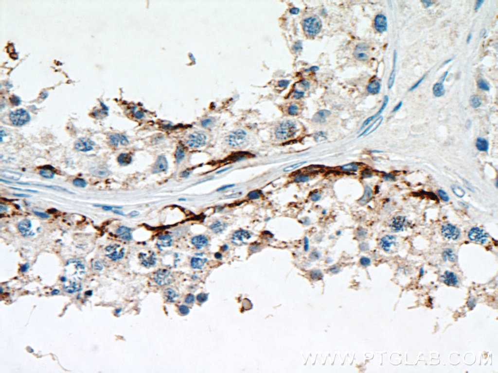 Immunohistochemistry (IHC) staining of human testis tissue using PYCR2 Polyclonal antibody (17146-1-AP)