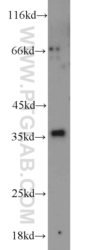 Western Blot (WB) analysis of Jurkat cells using PYCR2 Polyclonal antibody (17146-1-AP)