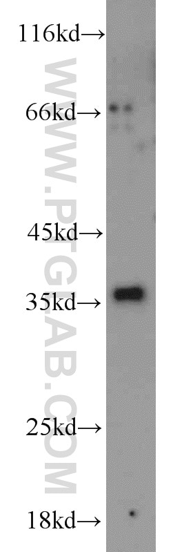 WB analysis of Jurkat using 17146-1-AP