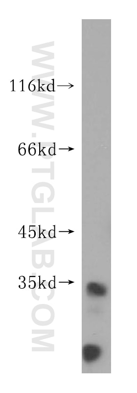 WB analysis of HeLa using 17146-1-AP