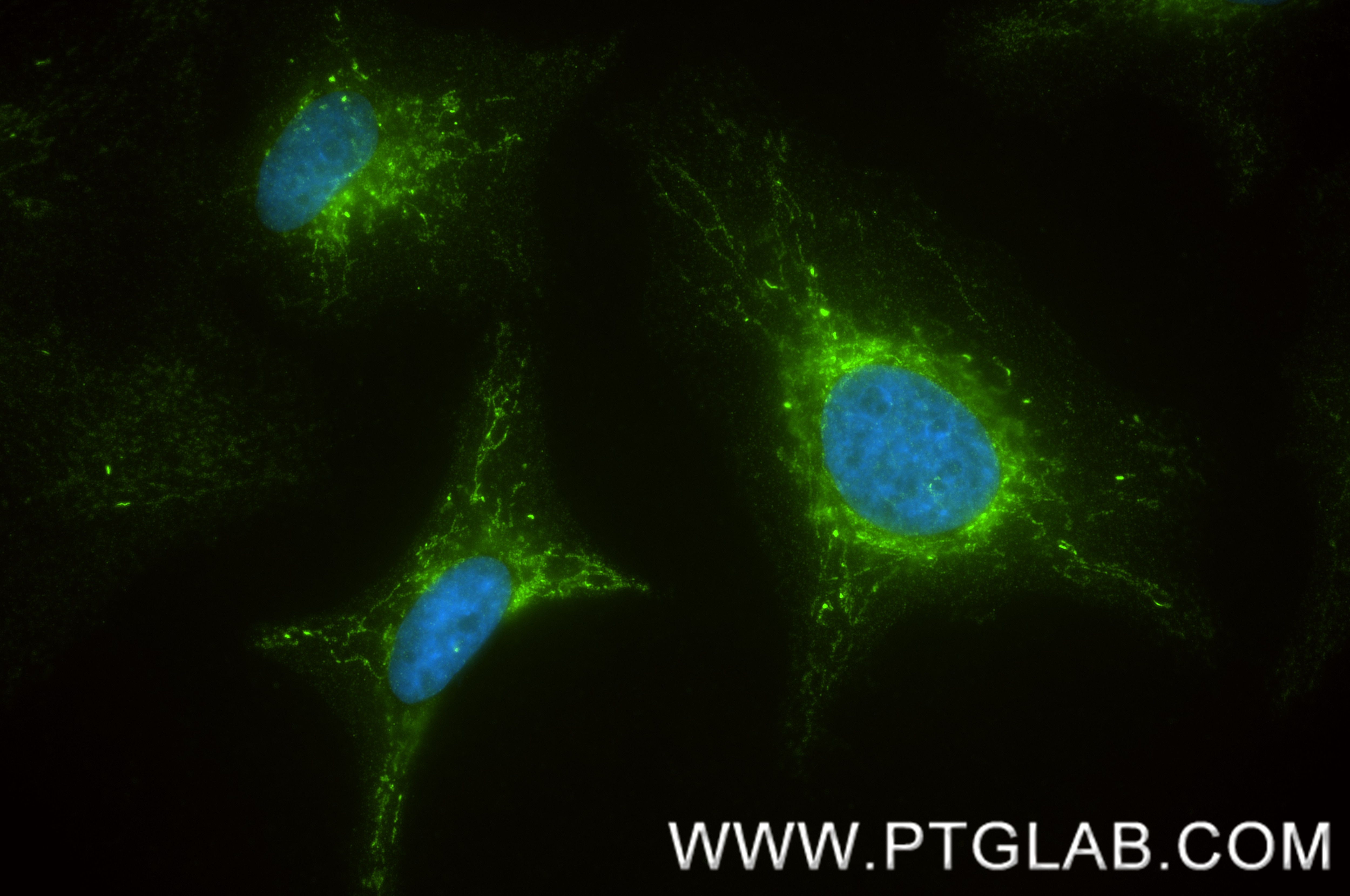 Immunofluorescence (IF) / fluorescent staining of HeLa cells using PYCR2 Recombinant monoclonal antibody (87985-2-RR)
