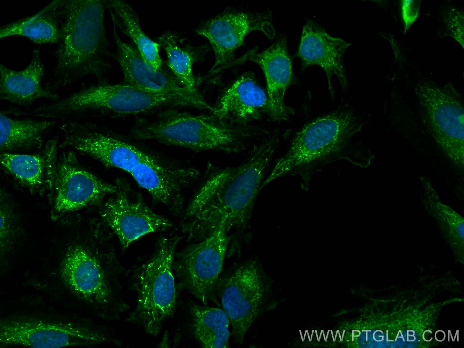 Immunofluorescence (IF) / fluorescent staining of HeLa cells using CoraLite® Plus 488-conjugated PYCR2 Polyclonal ant (CL488-17146)