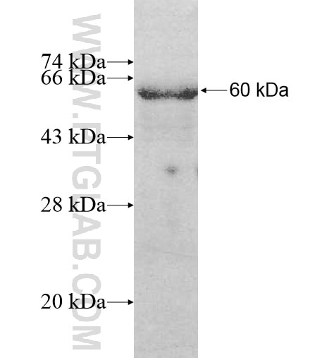 PYCR2 fusion protein Ag10918 SDS-PAGE