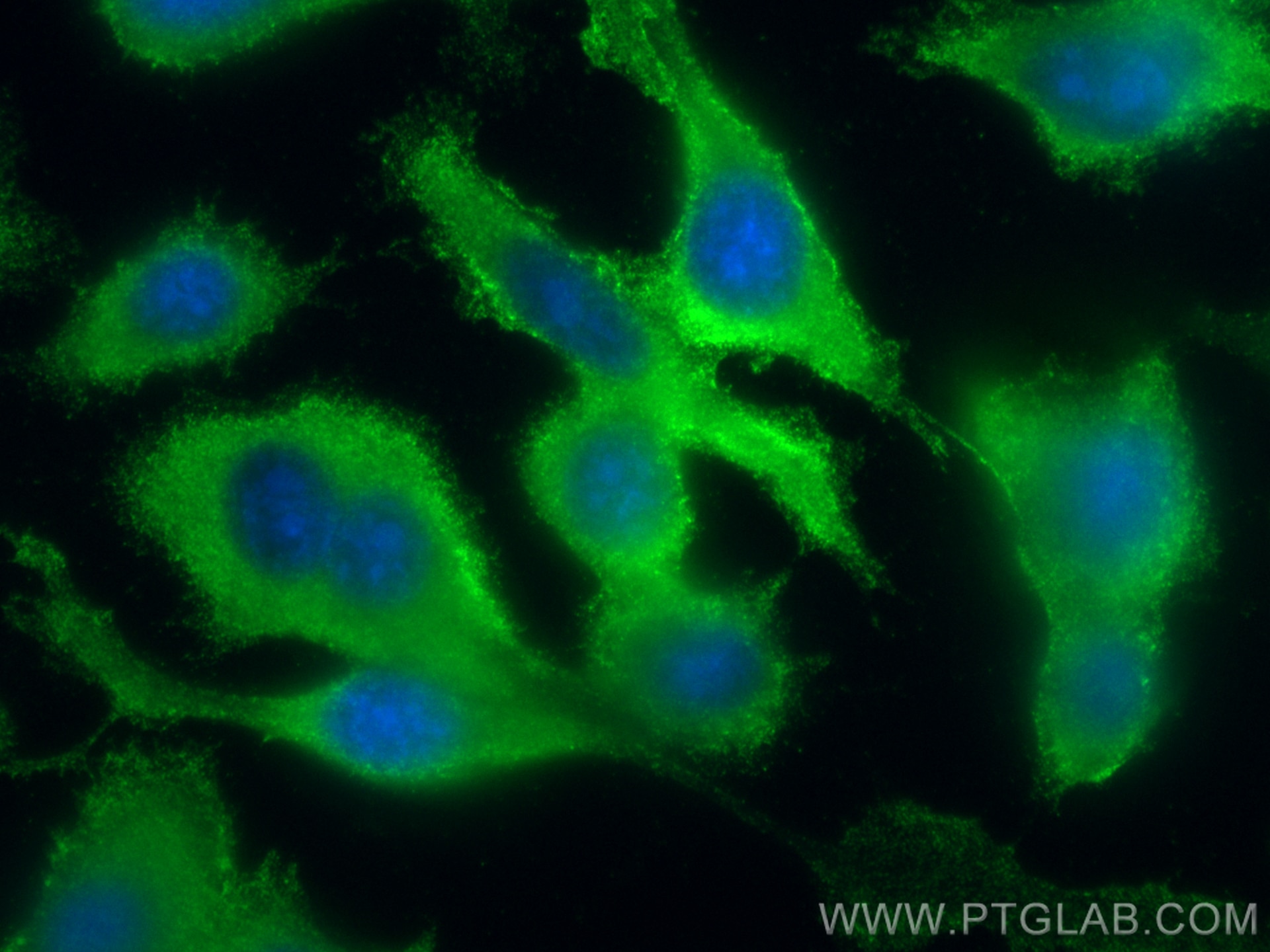 Immunofluorescent analysis of (-20°C Ethanol) fixed PC-3 cells using CoraLite® Plus 488 PYCRL antibody (CL488-68087, Clone: 1G7A3 ) at dilution of 1:200. Immunofluorescence (IF) / fluorescent staining of PC-3 cells using CoraLite® Plus 488-conjugated PYCRL Monoclonal ant (CL488-68087)