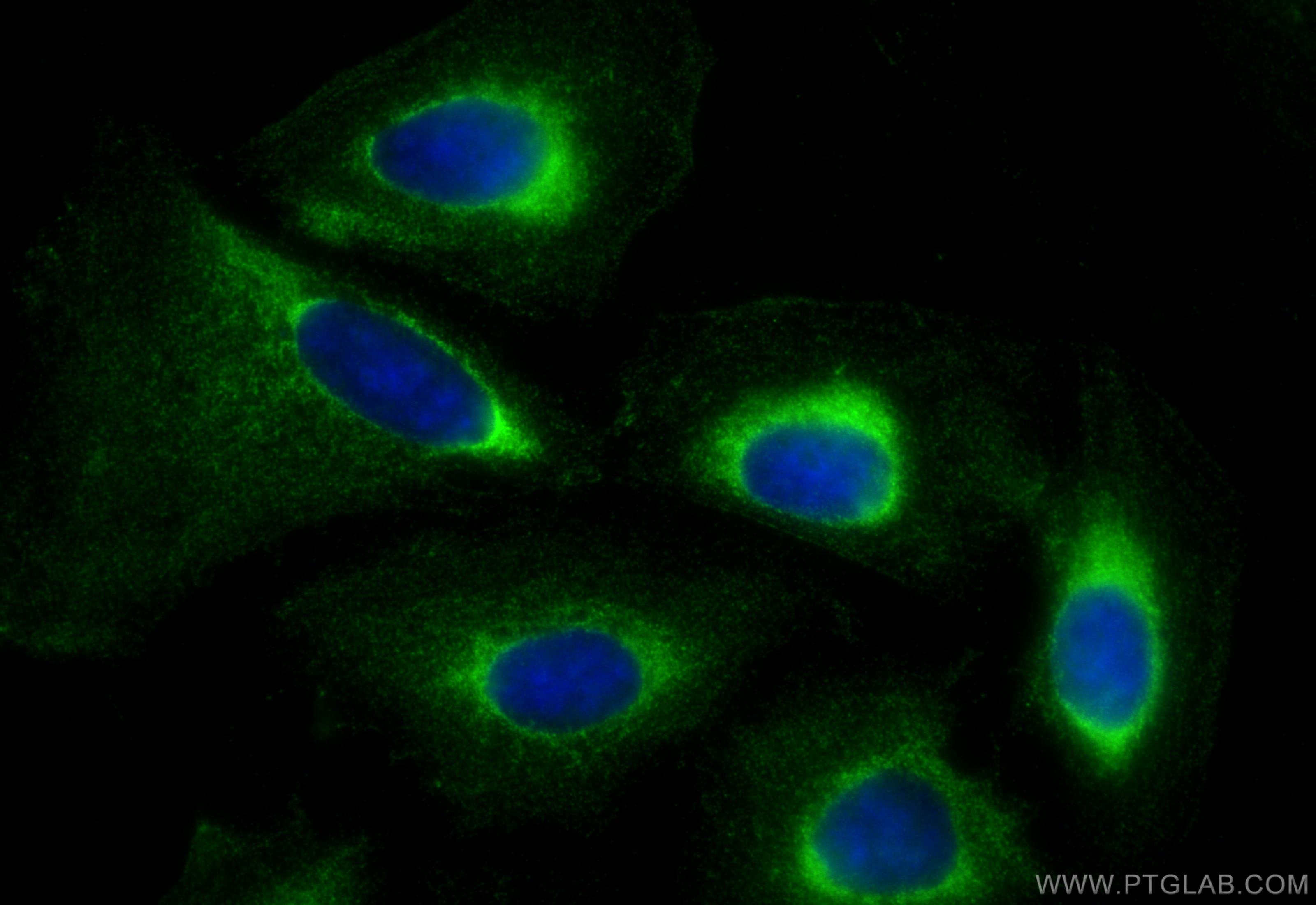 Immunofluorescent analysis of (-20°C Ethanol) fixed U2OS cells using CoraLite® Plus 488 PYCRL antibody (CL488-68087, Clone: 1G7A3 ) at dilution of 1:200. Immunofluorescence (IF) / fluorescent staining of U2OS cells using CoraLite® Plus 488-conjugated PYCRL Monoclonal ant (CL488-68087)