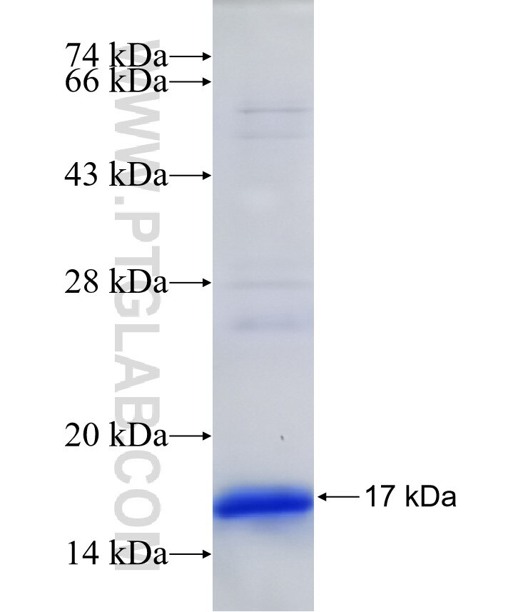 PYCRL fusion protein Ag31938 SDS-PAGE