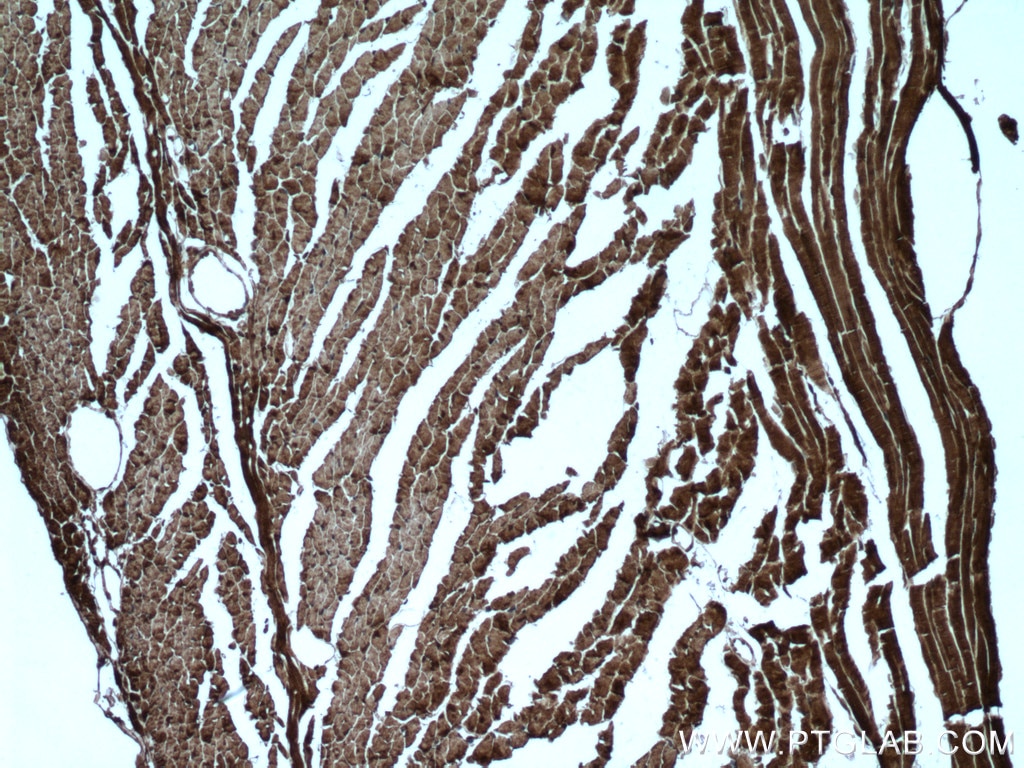 Immunohistochemistry (IHC) staining of mouse heart tissue using PYGB Polyclonal antibody (12075-1-AP)