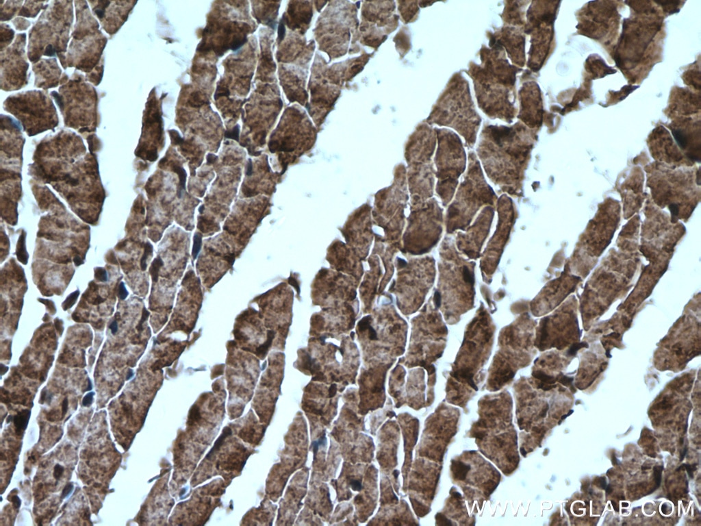 IHC staining of mouse heart using 12075-1-AP