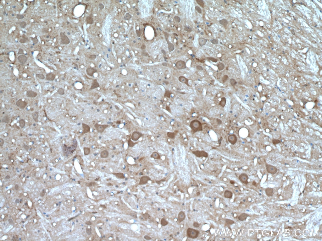 Immunohistochemistry (IHC) staining of rat brain tissue using PYGB Polyclonal antibody (12075-1-AP)