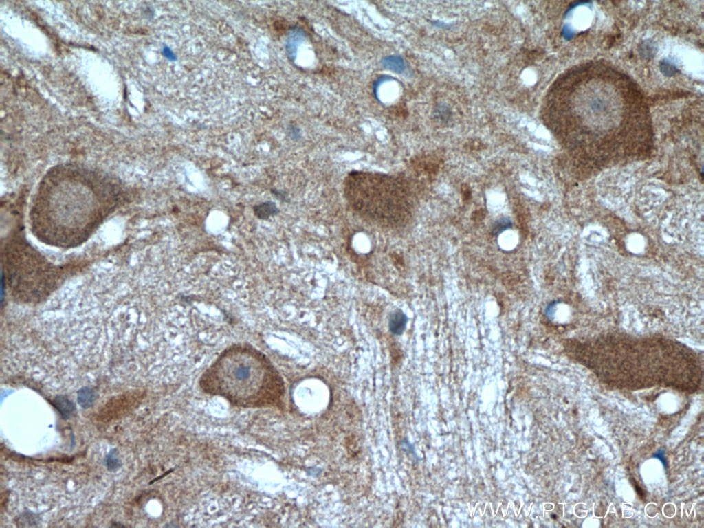 Immunohistochemistry (IHC) staining of rat brain tissue using PYGB Polyclonal antibody (12075-1-AP)