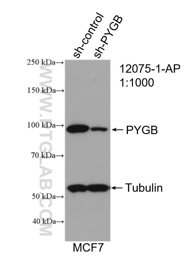 Western Blot (WB) analysis of MCF-7 cells using PYGB Polyclonal antibody (12075-1-AP)