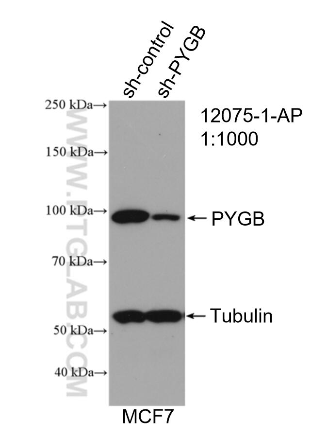 WB analysis of MCF-7 using 12075-1-AP