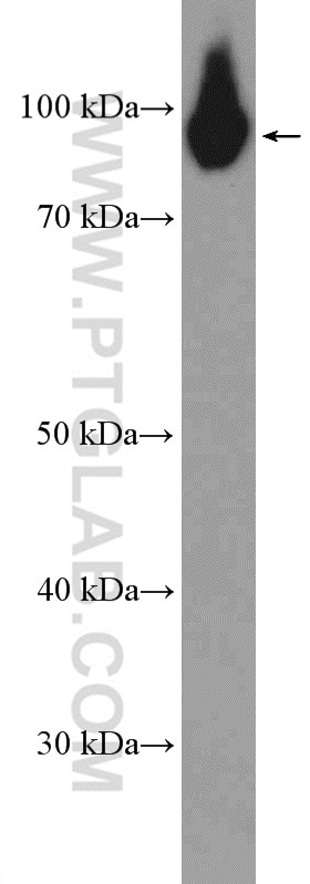 Western Blot (WB) analysis of rat brain tissue using PYGB Polyclonal antibody (12075-1-AP)