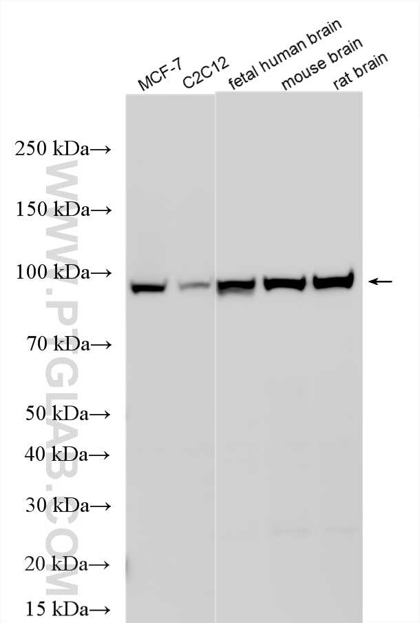 Various lysates were subjected to SDS PAGE followed by western blot with 12075-1-AP (PYGB antibody) at dilution of 1:5000 incubated at room temperature for 1.5 hours. Western Blot (WB) analysis of various lysates using PYGB Polyclonal antibody (12075-1-AP)