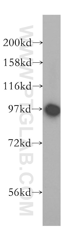 Western Blot (WB) analysis of human brain tissue using PYGB Polyclonal antibody (12075-1-AP)