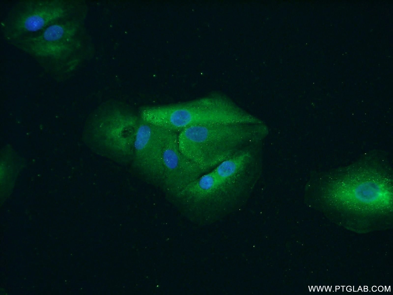 Immunofluorescence (IF) / fluorescent staining of A549 cells using PYGB Polyclonal antibody (55380-1-AP)