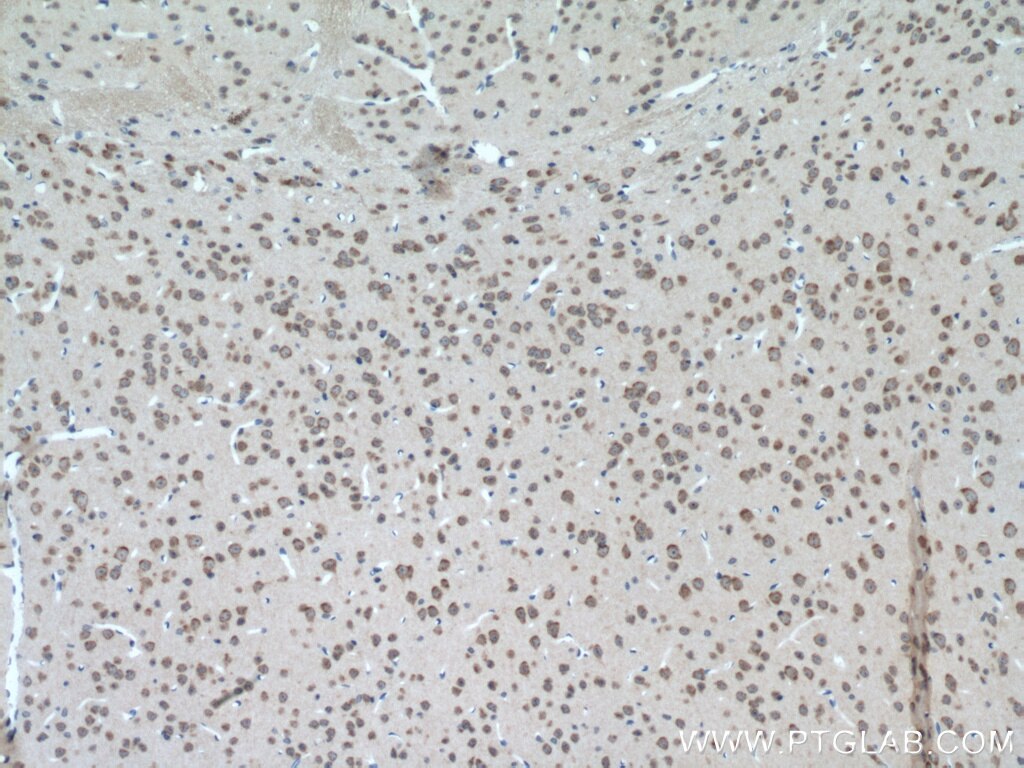 Immunohistochemistry (IHC) staining of mouse brain tissue using PYGB Polyclonal antibody (55380-1-AP)