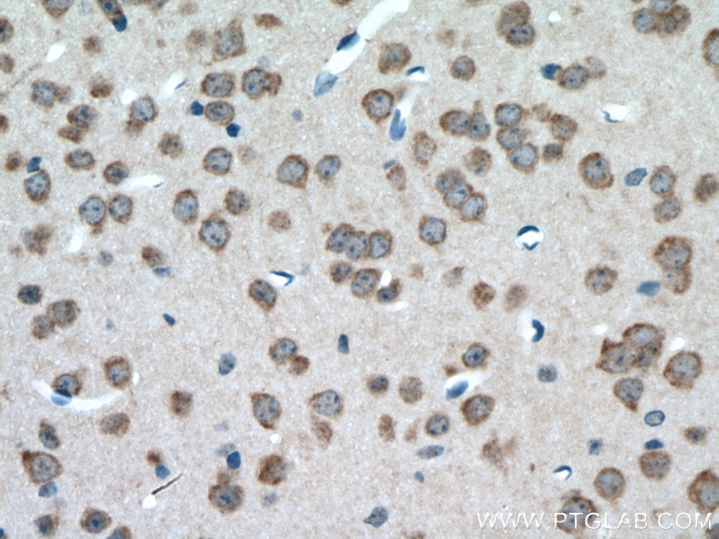 Immunohistochemistry (IHC) staining of mouse brain tissue using PYGB Polyclonal antibody (55380-1-AP)