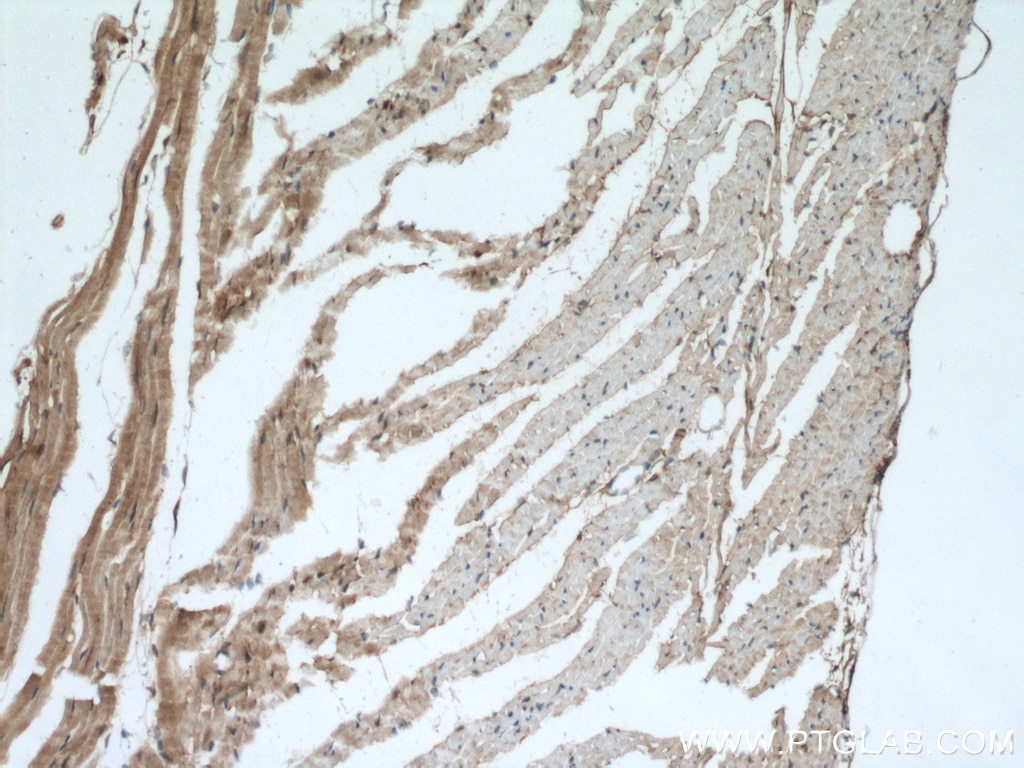 Immunohistochemistry (IHC) staining of mouse heart tissue using PYGB Polyclonal antibody (55380-1-AP)
